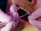 Protetyka stomatologiczna – o czym mowa w praktyce?